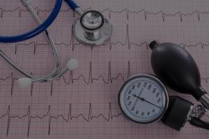 EKG